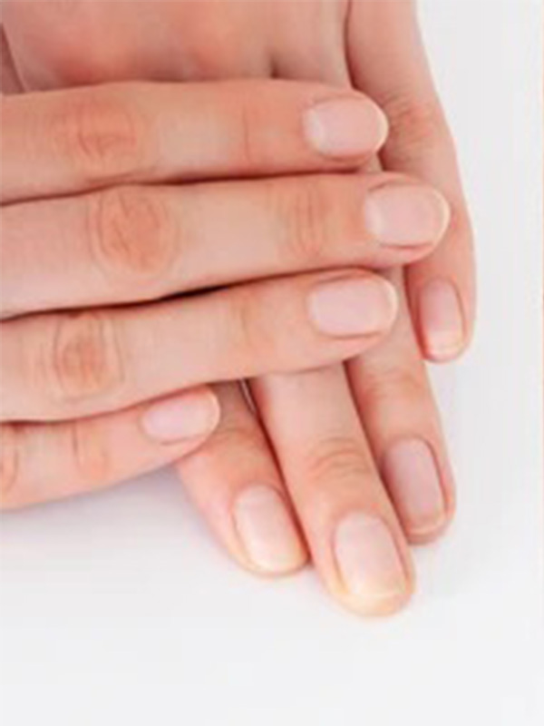 Nails Before Transformation